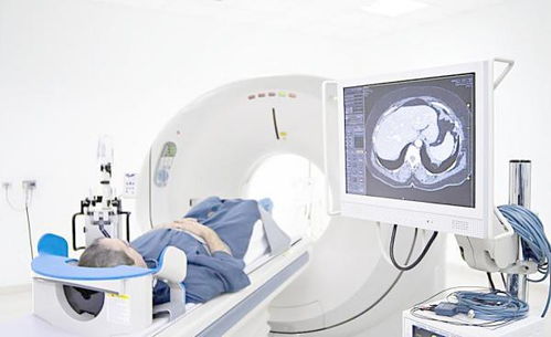 第一类医疗器械经营 无需备案，但需合规